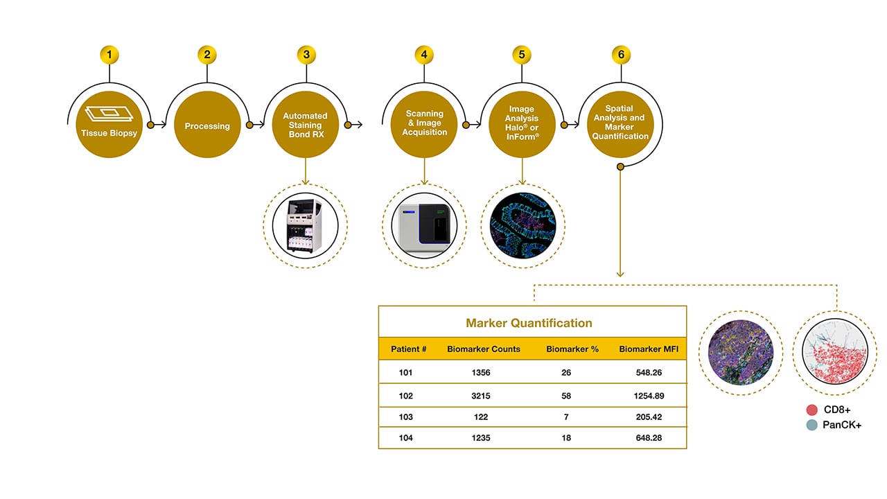 Precision for Medicine's customized workflows generate complex insights from multiplex IF