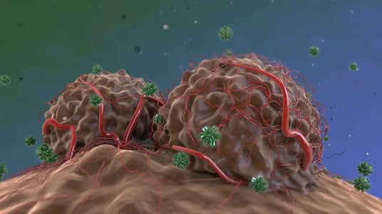 Assessing the Tumor Microenvironment to Optimize Clinical Trial Success: Spatial Analysis with Multiplex Immunofluorescence
