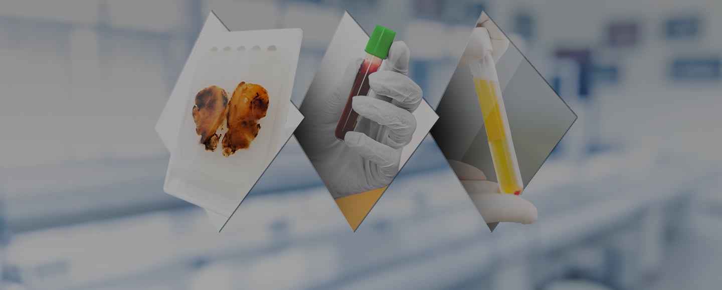 MTB Page Header_1440x580_144 1