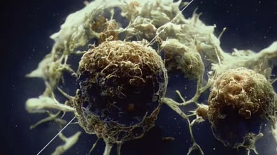 Cell Therapy Clinical Trials