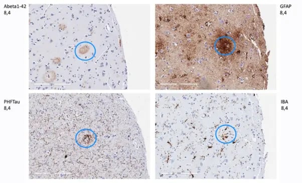 PFM-Figure-3-Evaluation-of-staining-patterns-in-matched-fields-of-view-602x366