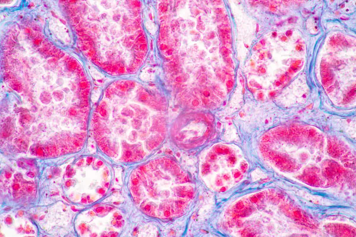 tissue-cross-reactivity_header