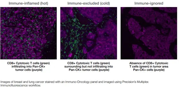 Tumeurs chaudes vs froides
