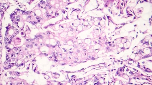 Immunohistochemistry Assay