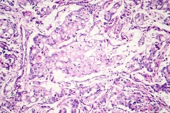 Precision tissue analysis services